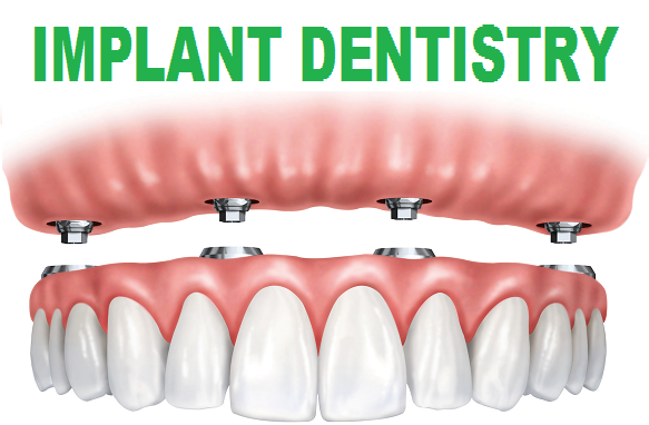 Invisalign Provider Invisalign Provider