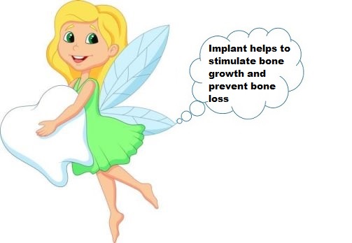 Batavia Implant dentistry Batavia Implant dentistry